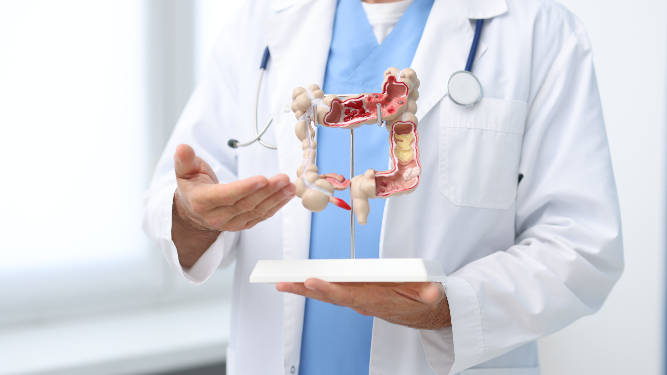 Permeabilidad-intestinal